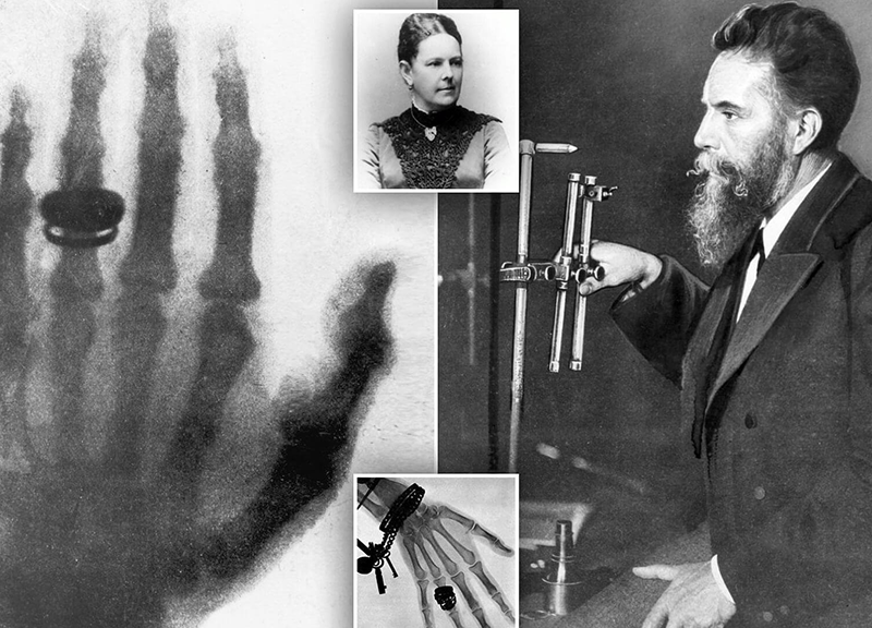 История рентгеновского аппарата: какие были и какие есть сейчас