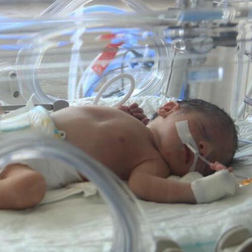 Как выхаживают недоношенных детей