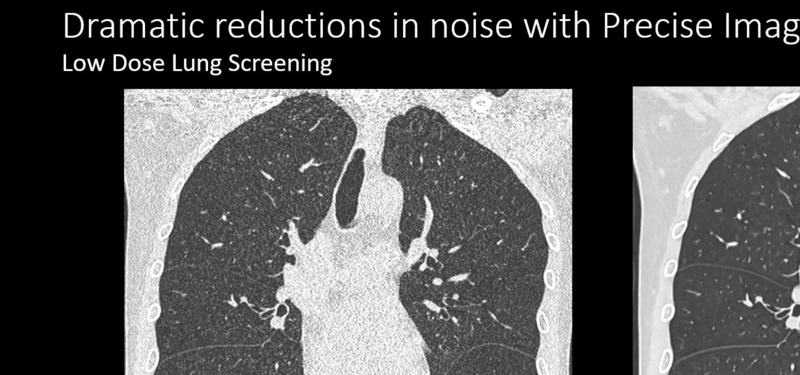 Система компьютерной томографии Philips CT 3500