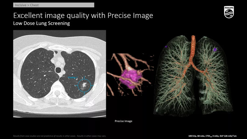 Система компьютерной томографии Philips Incisive CT
