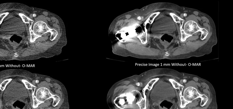 Система компьютерной томографии Philips Incisive CT