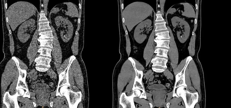 Система компьютерной томографии Philips Incisive CT