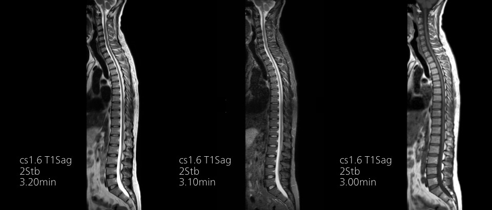 МРТ Philips MR 5300: легкие катушки Breeze обеспечивают гибкость при визуализации сложных анатомических областей и мельчайших суставов