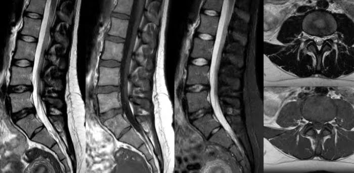 В магнитно-резонансном томографе Philips MR 5300 применяется технология Compressed SENSE, позволяющая ускорить анализ изображений, повысить диагностическую достоверность