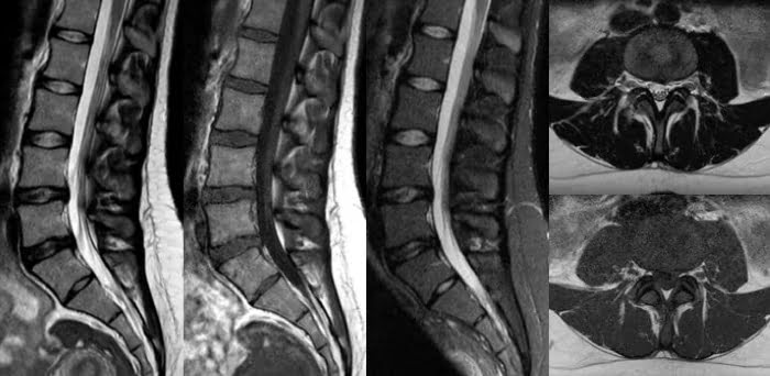 Система Philips MR 5300 ускоряет подготовку, запуск, визуализацию и расшифровку магнитно-резонансной томографии